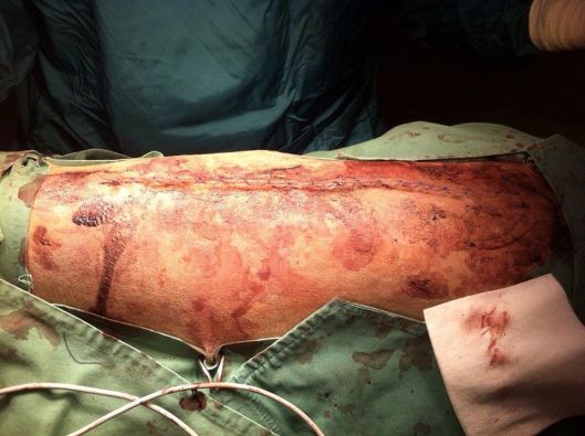 10178196_942194462462857_859765521_n